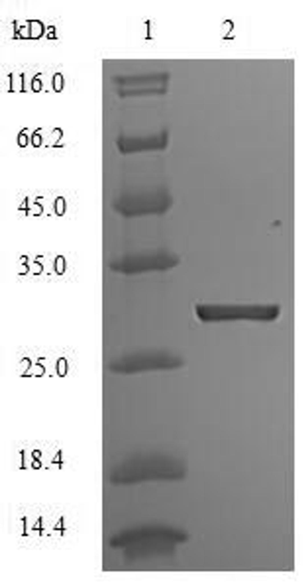 (Tris-Glycine gel) Discontinuous SDS-PAGE (reduced) with 5% enrichment gel and 15% separation gel.
