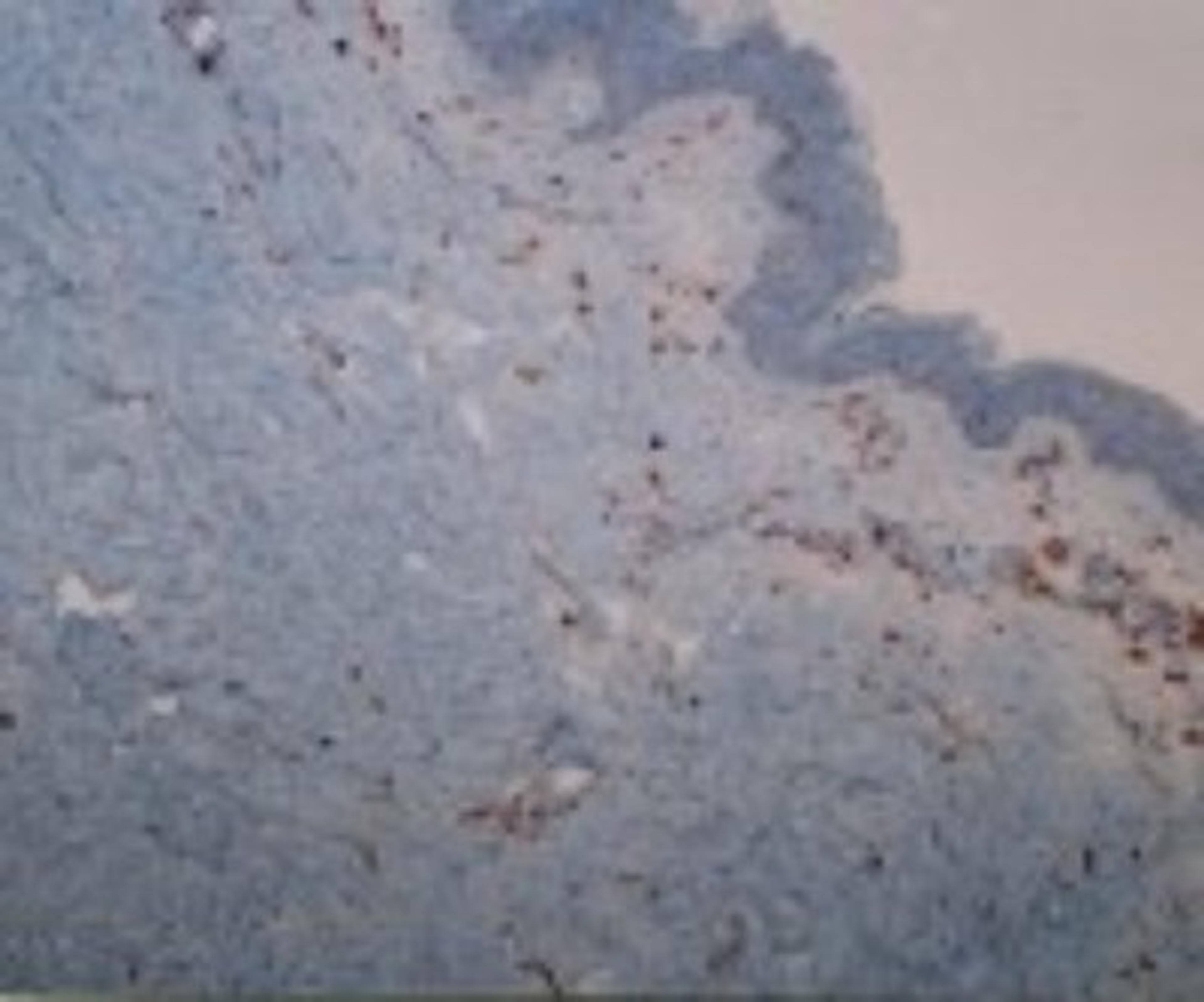 Immunohistochemistry-Frozen: DC-SIGNR/CD299/CLEC4M Antibody (118A8.05) [DDX0200P-100] - Analysis using the Biotin conjugate of DDX0200P-100. Staining of human skin frozen section.