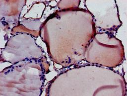 Immunohistochemistry of paraffin-embedded human thyroid tissue using CSB-PA865113LA01HU at dilution of 1:100