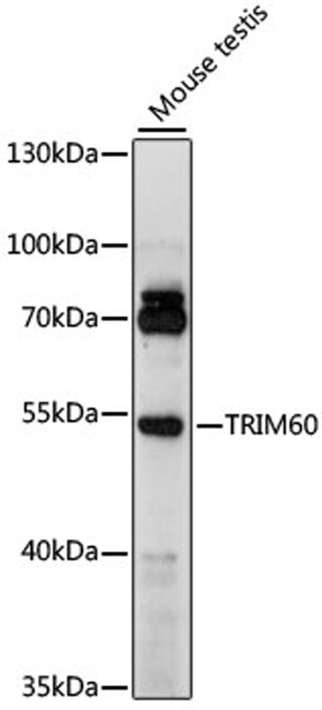 Western blot - TRIM60 antibody (A15963)