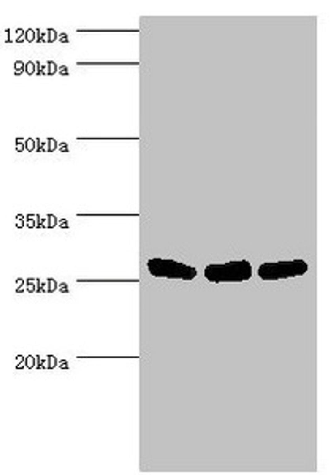 Western blot. All lanes: Adenylate kinase 2, mitochondrial antibody at 5ug/ml. Lane 1: Hela whole cell lysate. Lane 2: Mouse kidney tissue. Lane 3: Mouse small intestine tissue. Secondary. Goat polyclonal to rabbit IgG at 1/10000 dilution. Predicted band size: 27, 26, 23, 15, 25, 22 kDa. Observed band size: 27 kDa. 