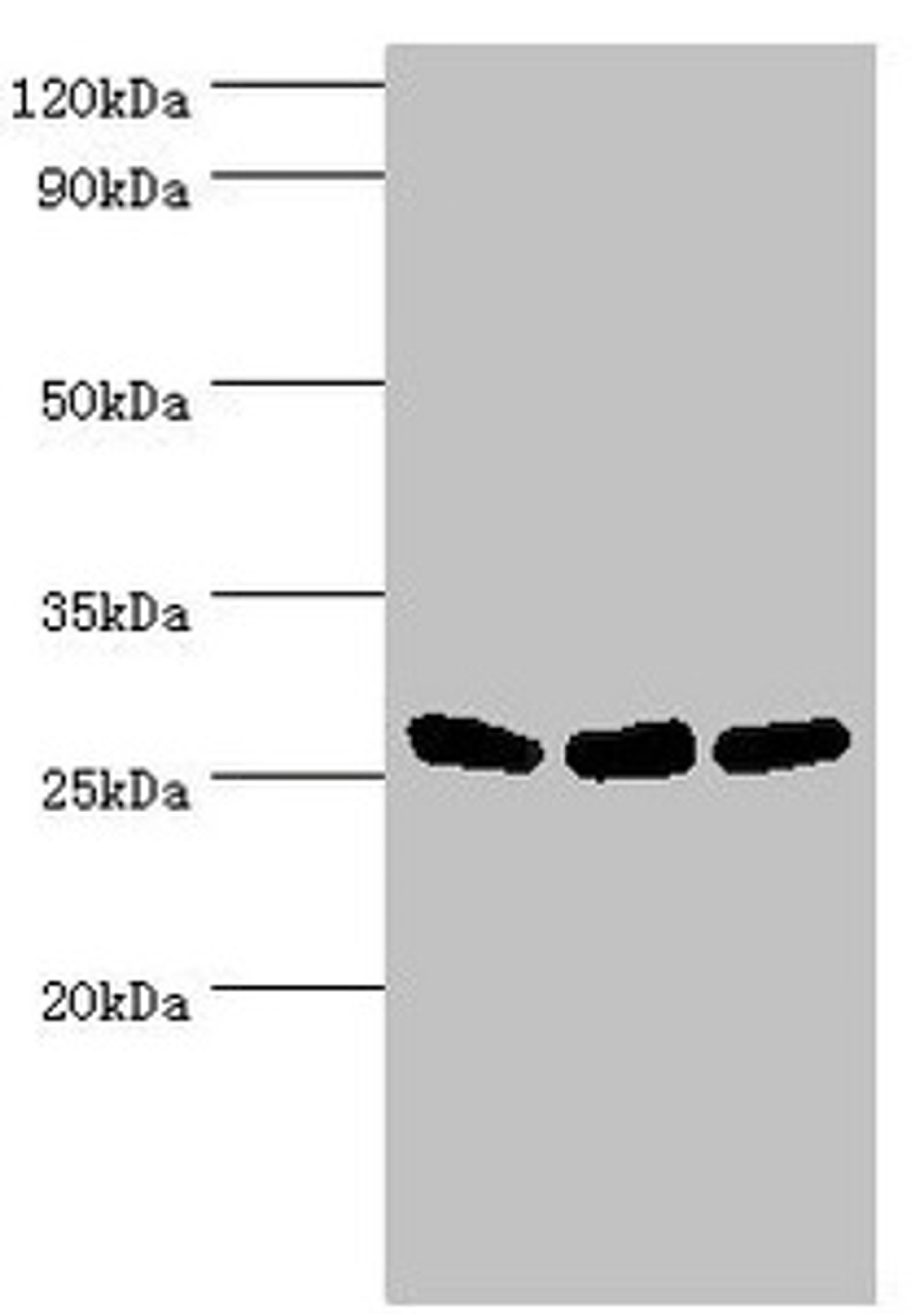 Western blot. All lanes: Adenylate kinase 2, mitochondrial antibody at 5ug/ml. Lane 1: Hela whole cell lysate. Lane 2: Mouse kidney tissue. Lane 3: Mouse small intestine tissue. Secondary. Goat polyclonal to rabbit IgG at 1/10000 dilution. Predicted band size: 27, 26, 23, 15, 25, 22 kDa. Observed band size: 27 kDa. 