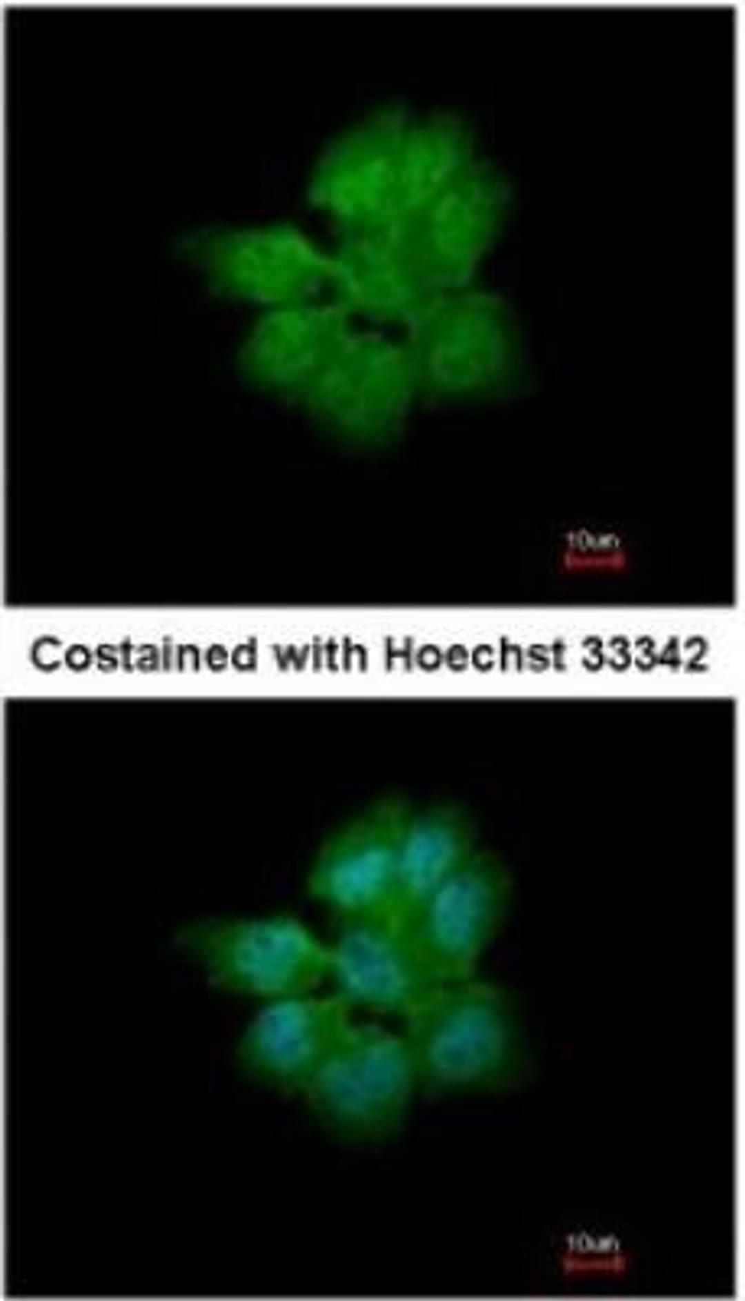 Immunocytochemistry/Immunofluorescence: SMURF2 Antibody [NBP1-31211] - Paraformaldehyde-fixed A431, using antibody at 1:200 dilution.