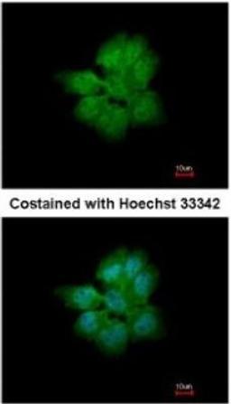 Immunocytochemistry/Immunofluorescence: SMURF2 Antibody [NBP1-31211] - Paraformaldehyde-fixed A431, using antibody at 1:200 dilution.