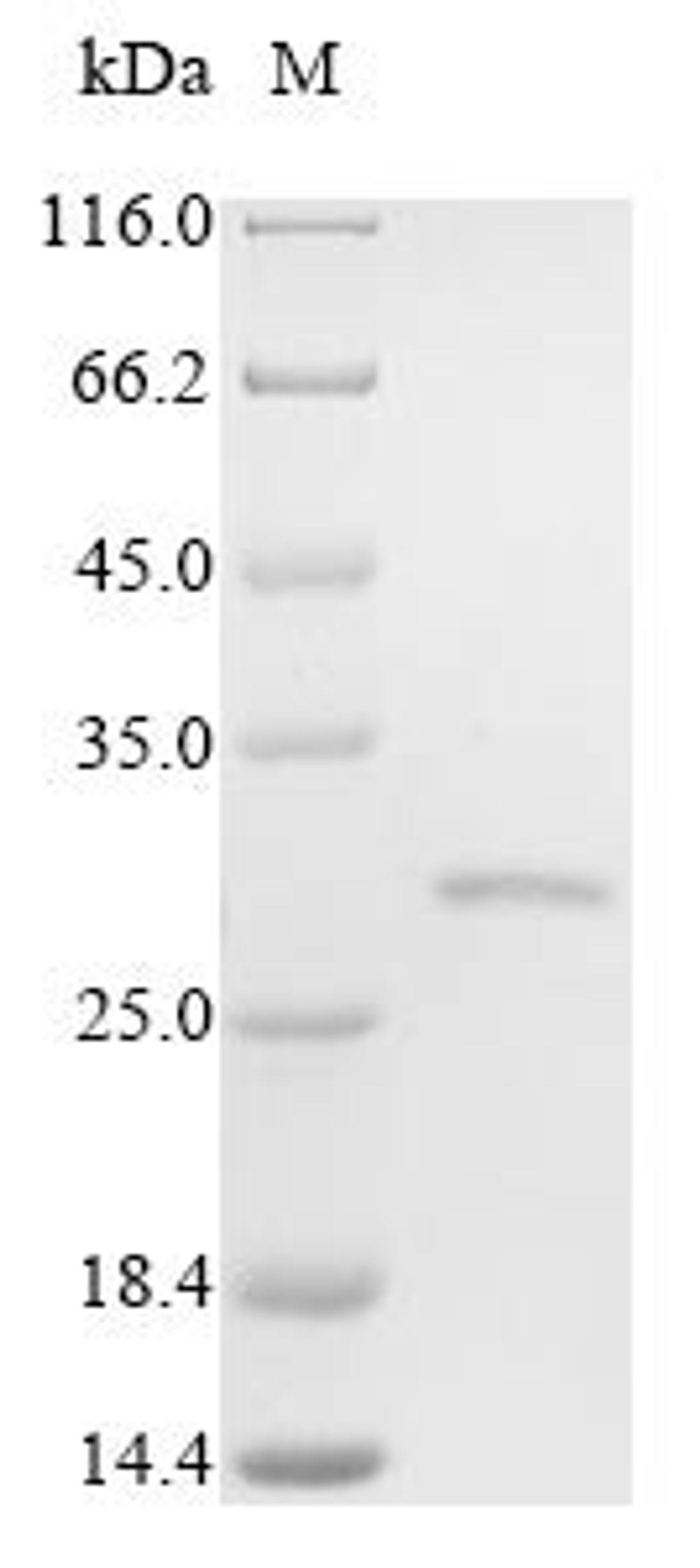 (Tris-Glycine gel) Discontinuous SDS-PAGE (reduced) with 5% enrichment gel and 15% separation gel.