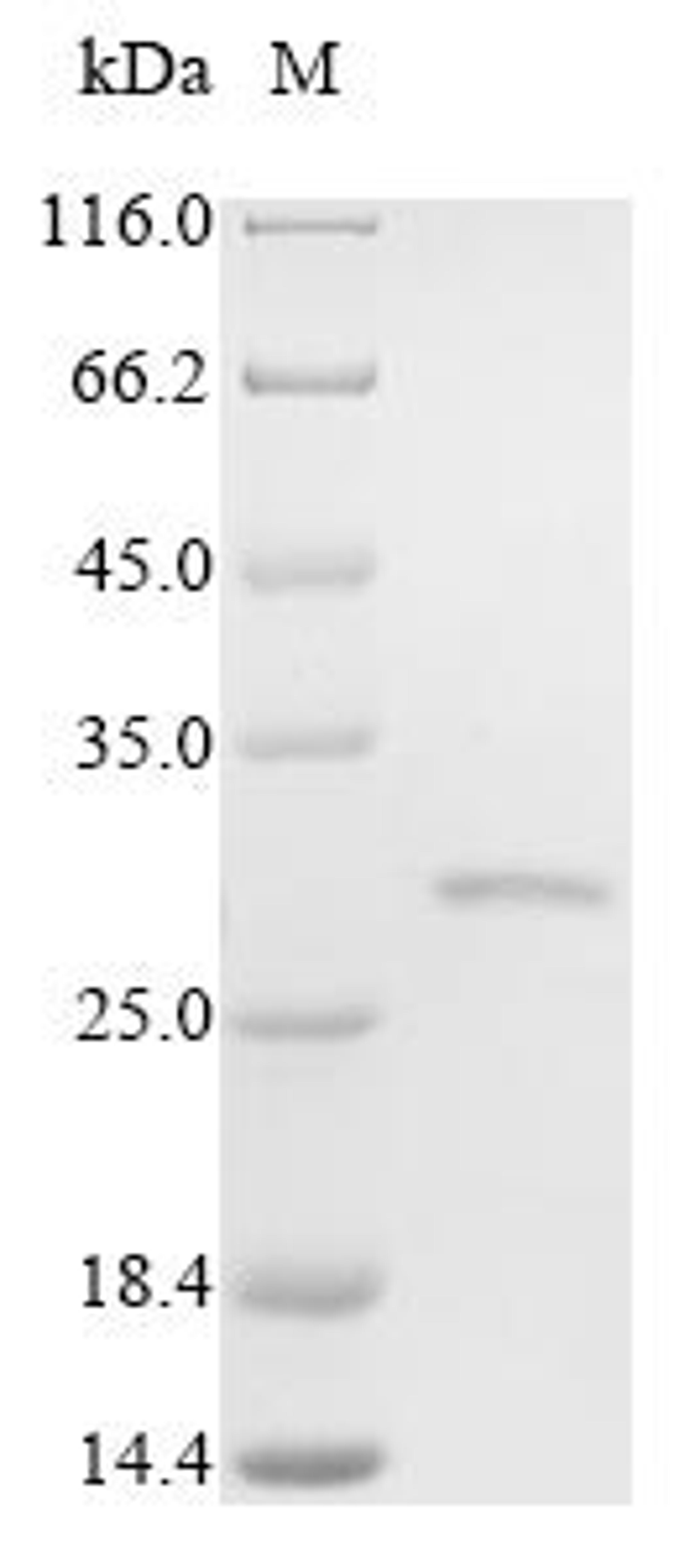 (Tris-Glycine gel) Discontinuous SDS-PAGE (reduced) with 5% enrichment gel and 15% separation gel.
