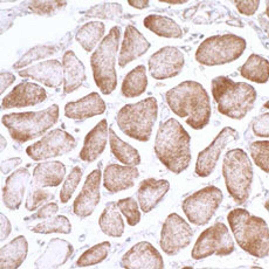 Detection of human AMPK alpha 1 by immunohistochemistry.