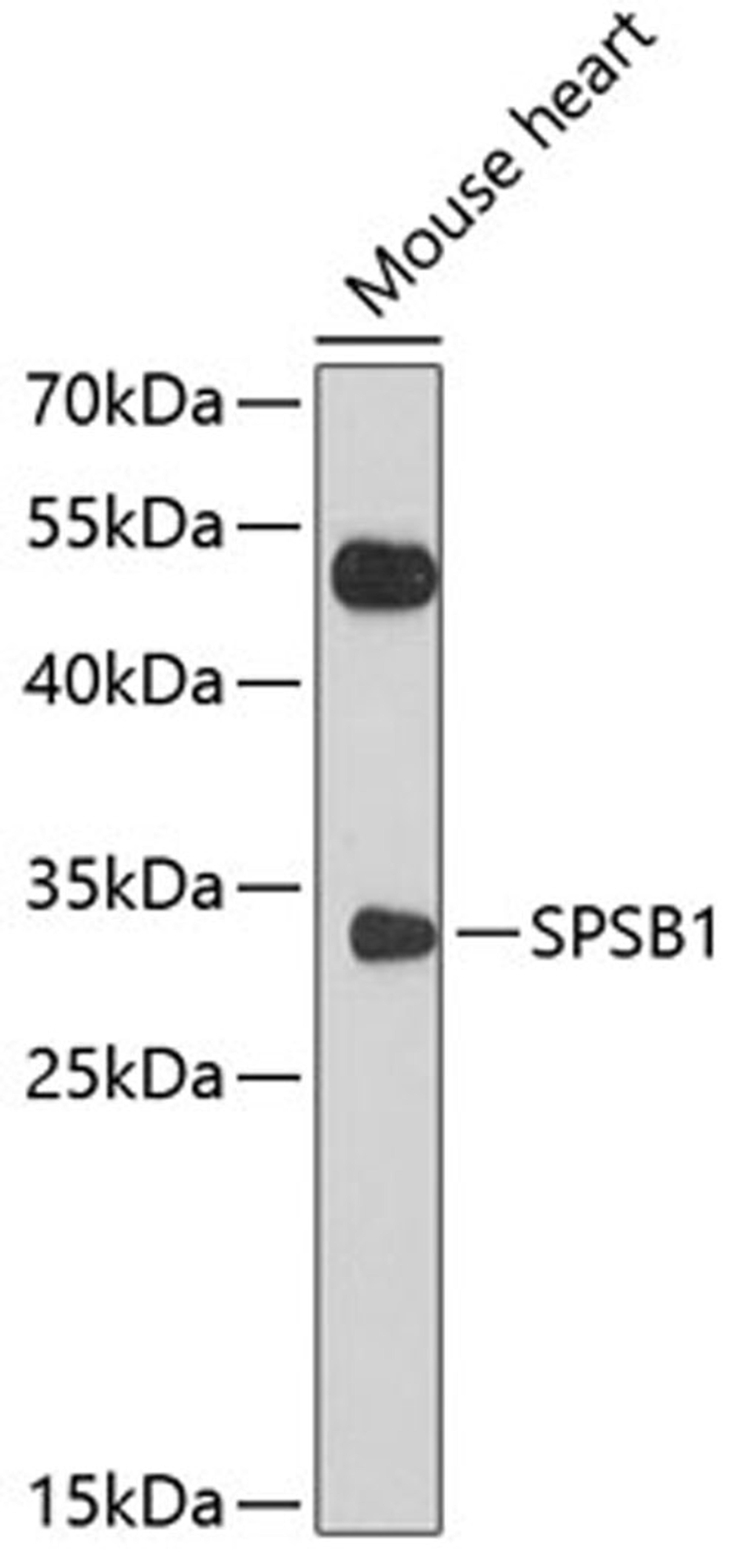 Western blot - SPSB1 antibody (A10325)