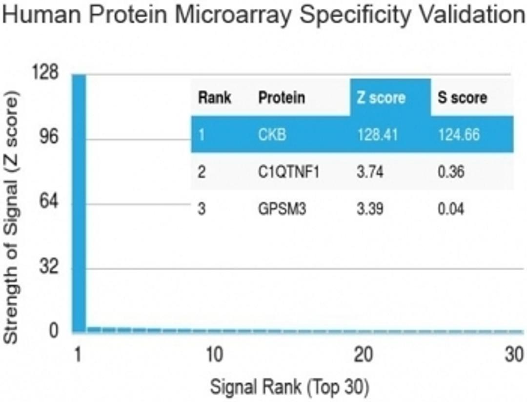 Analysis of HuProt(TM) microarray containing more than 19,000 full-length human proteins using Creatine kinase B type antibody (clone 2ba6).  Z- and S- score: The Z-score represents the strength of a signal that an antibody (in combination with a fluoresc