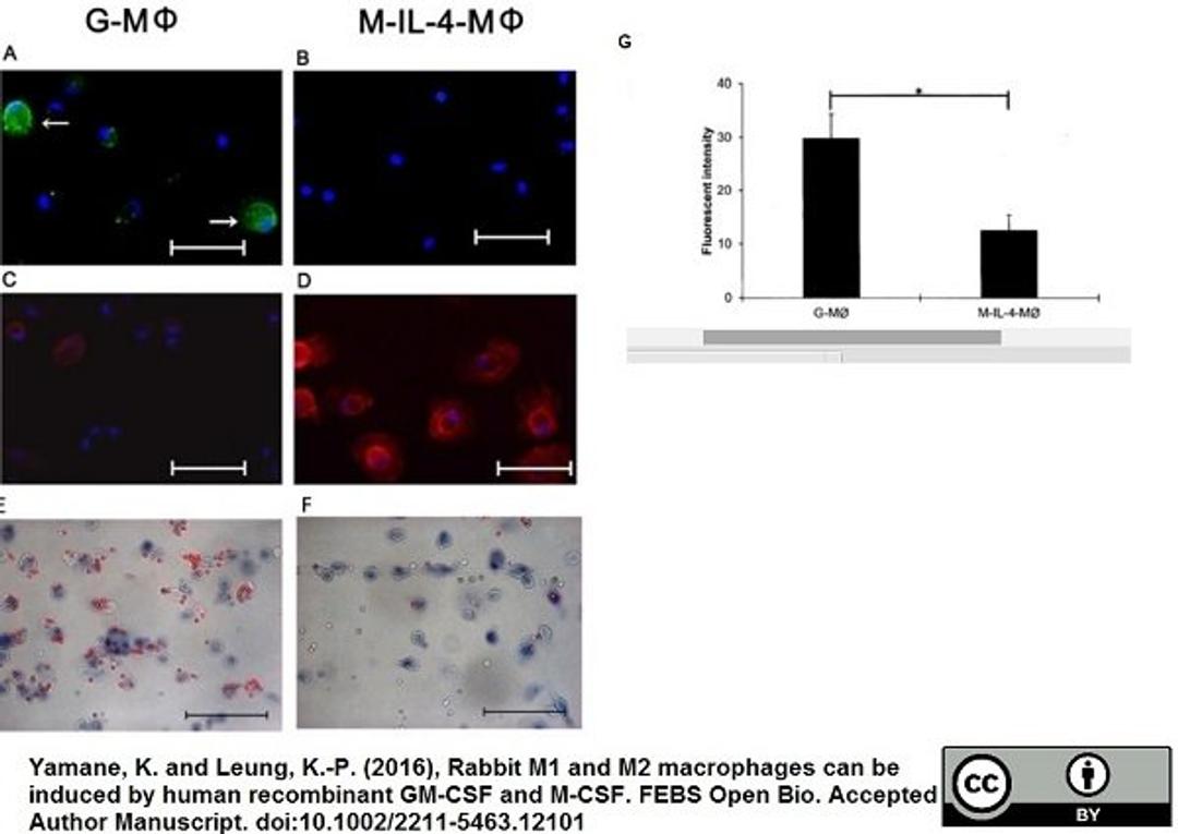 Mouse anti Humaqn CD206 antibody used for the identification of M2 macrophages