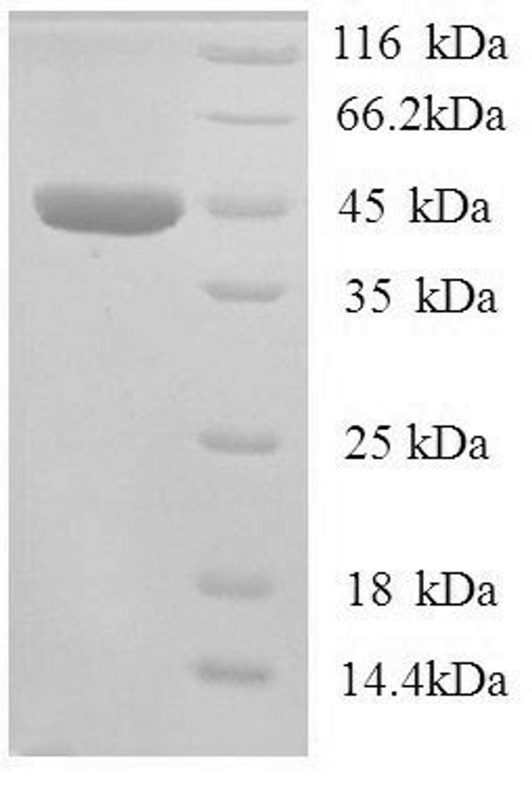 (Tris-Glycine gel) Discontinuous SDS-PAGE (reduced) with 5% enrichment gel and 15% separation gel.