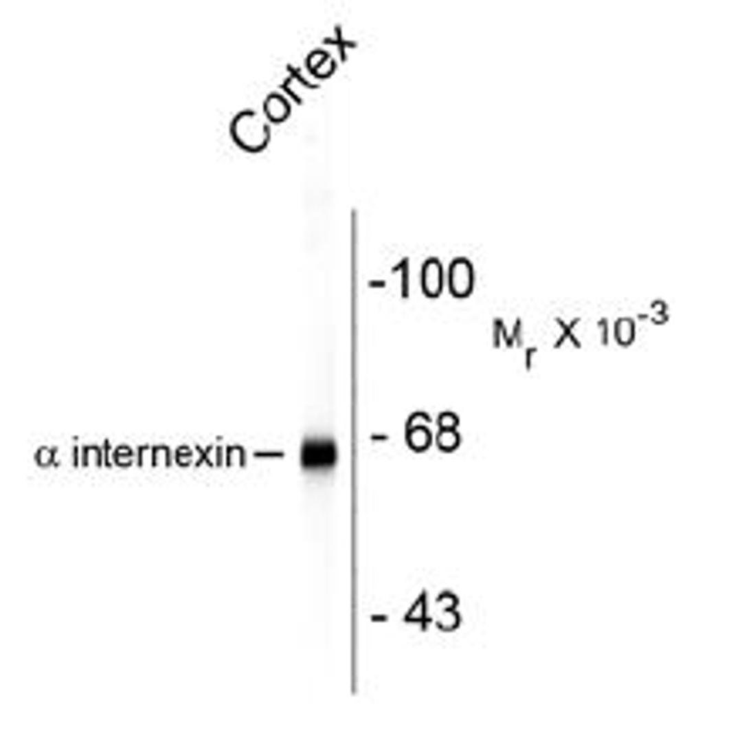 Western blot of rat cortex lysate showing specific immunolabeling of the ~ 66k alpha internexin protein.