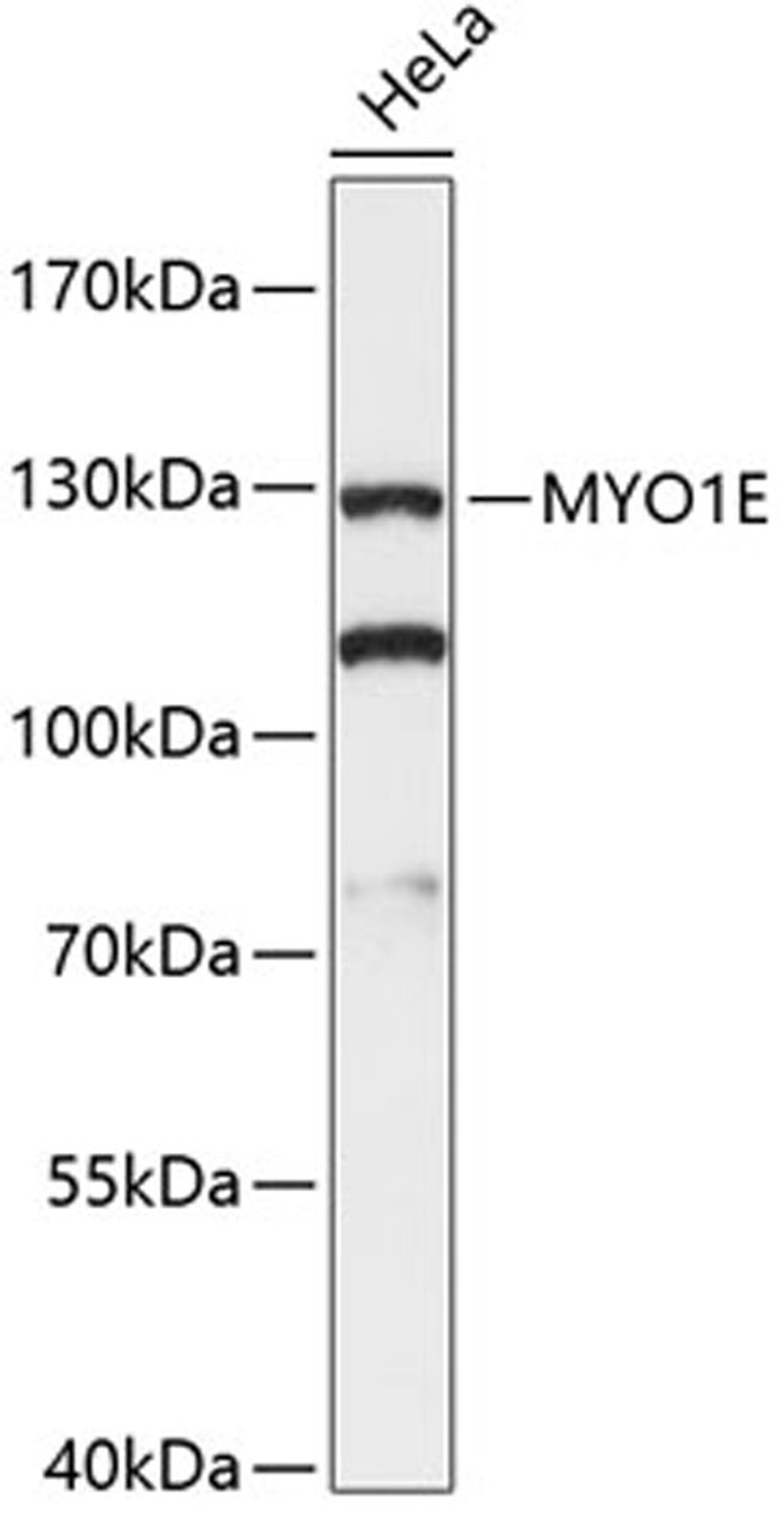 Western blot - MYO1E antibody (A13032)