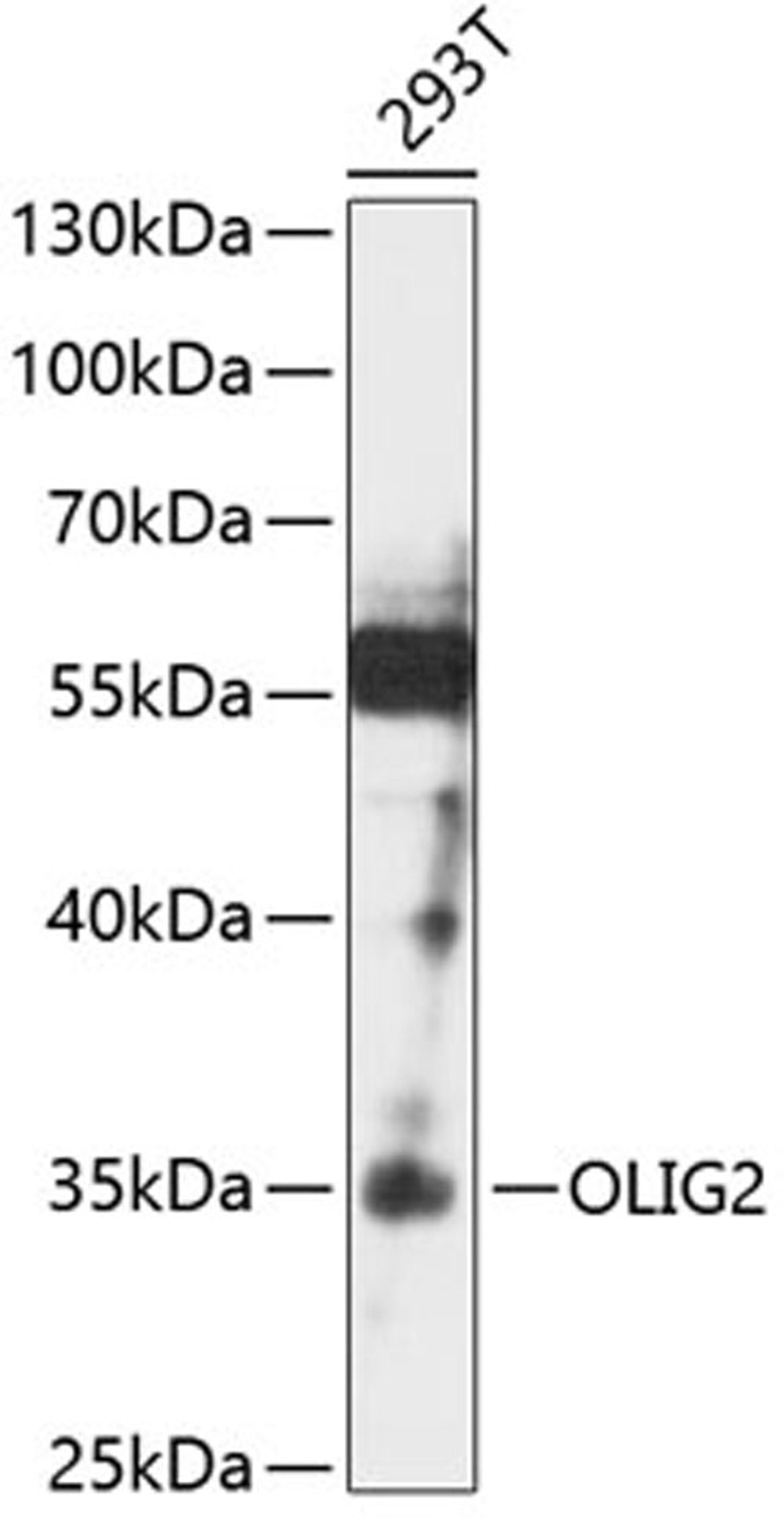 Western blot - OLIG2 antibody (A12814)