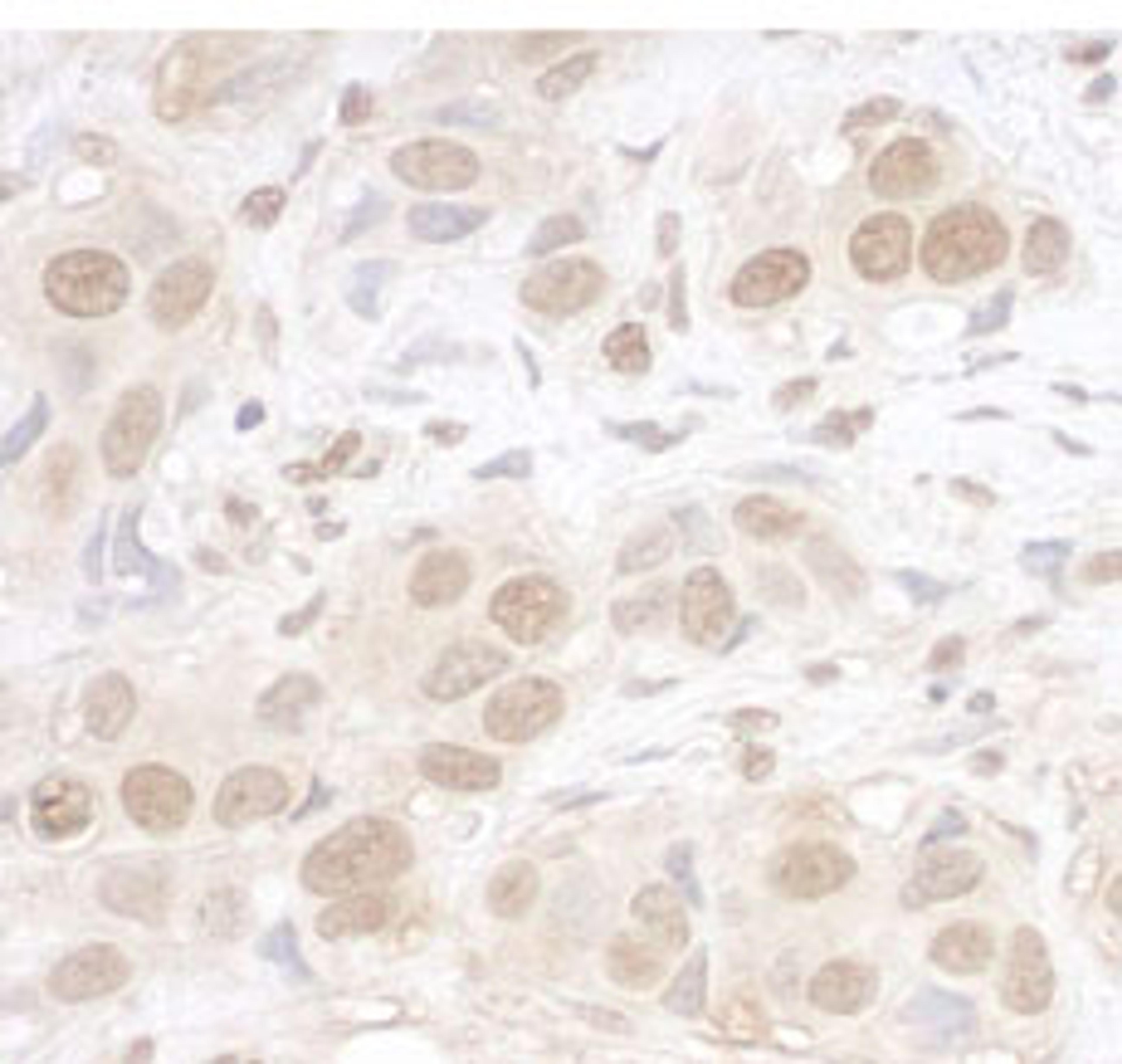 Detection of human ARID3B by immunohistochemistry.