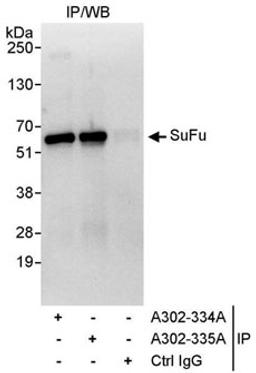 Detection of human SuFu by western blot of immunoprecipitates.