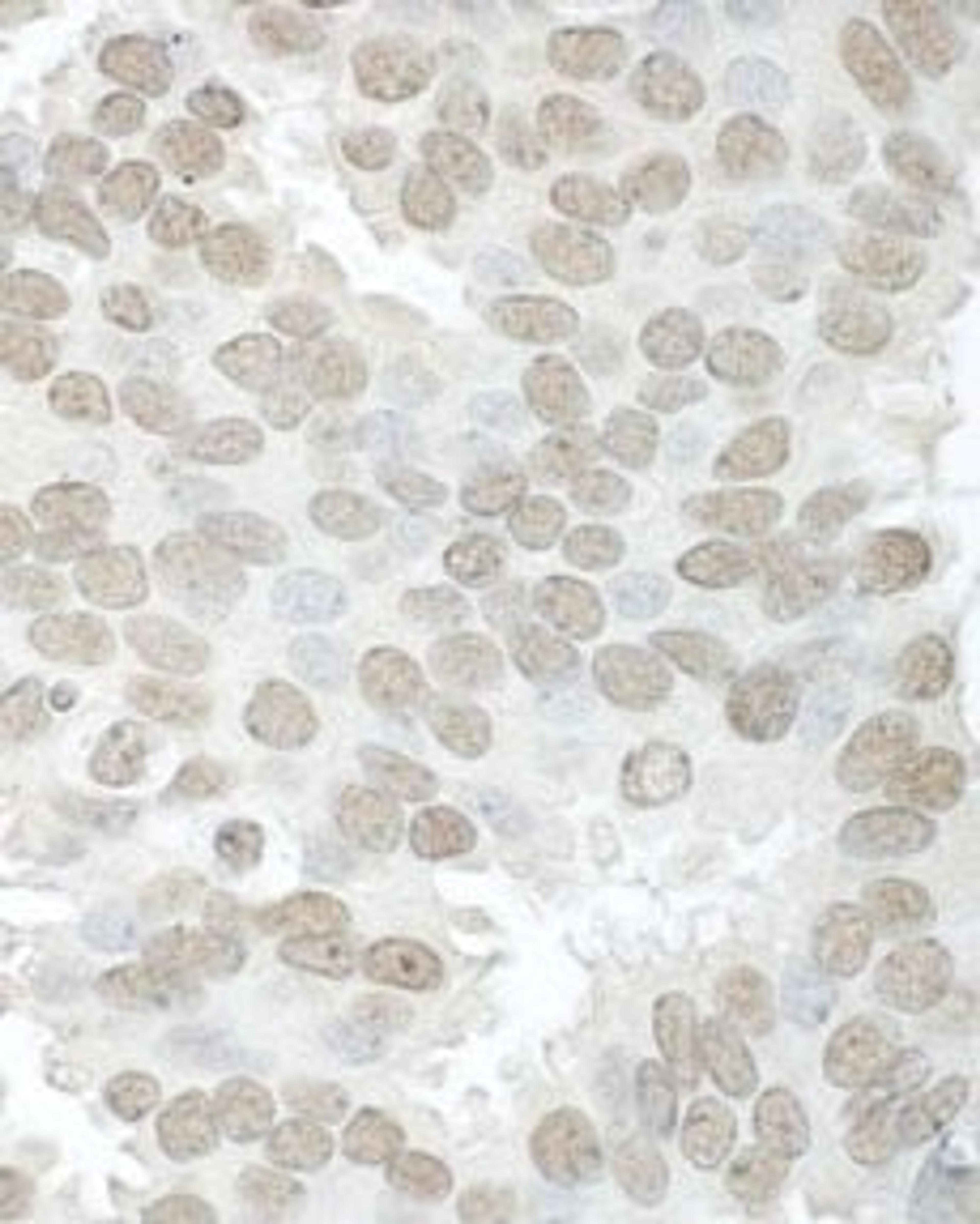 Detection of human Aly by immunohistochemistry.