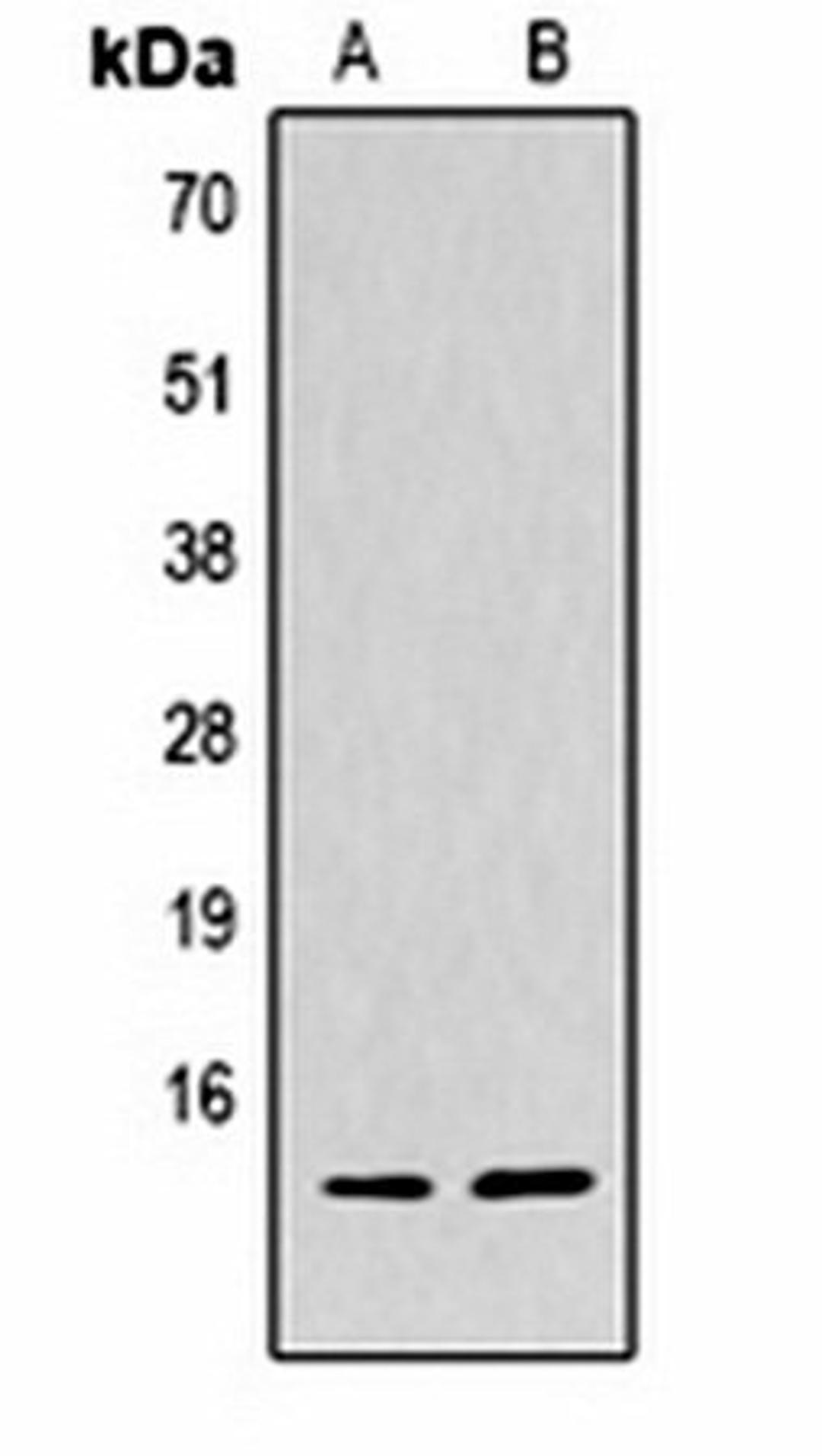 Western blot analysis of  Hela (Lane1), NIH3T3 (Lane2) whole cell lysates using Histone H4 (TriMethyl K59) antibody