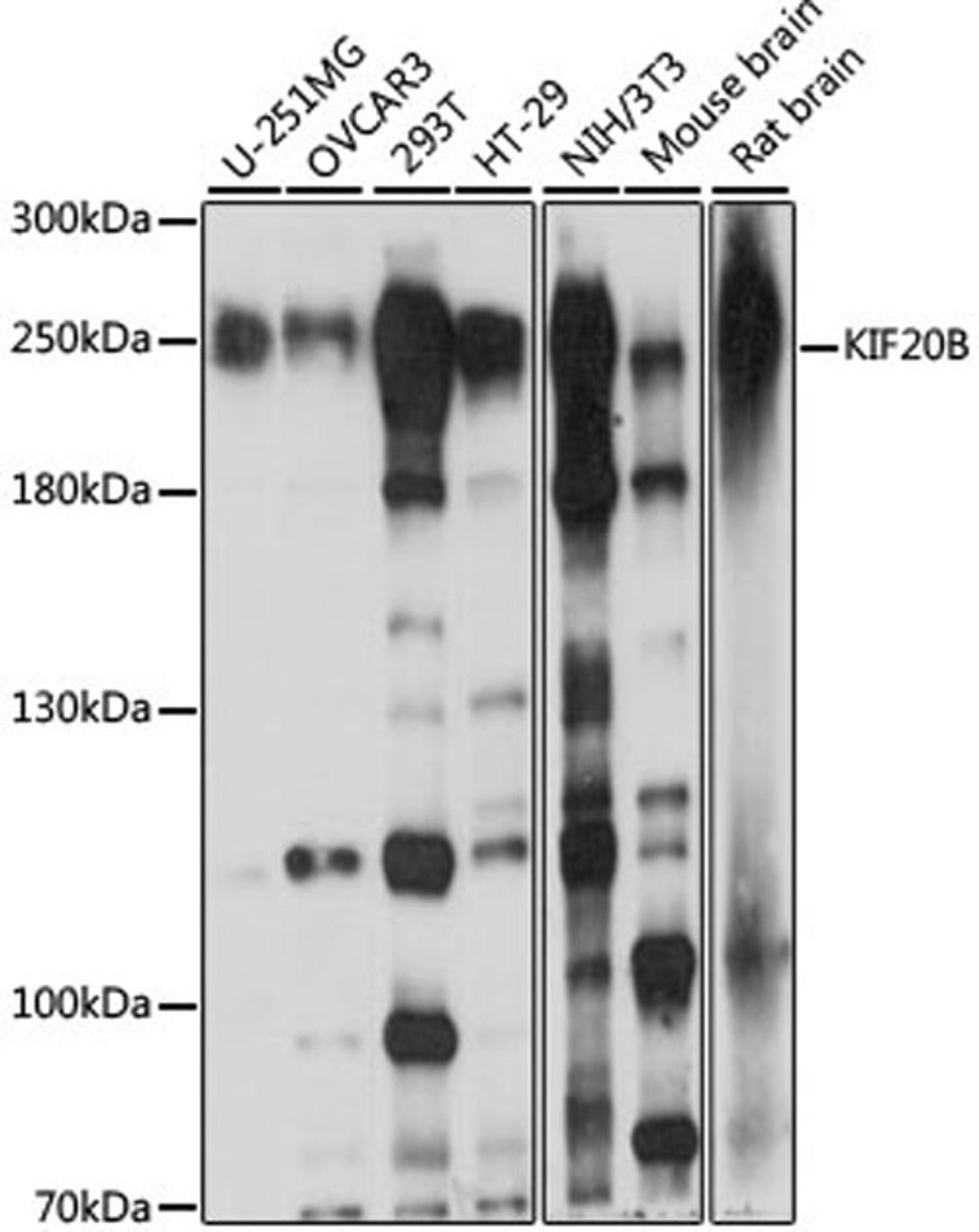 Western blot - KIF20B antibody (A15360)