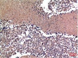 Immunohistochemical analysis of paraffin-embedded Human lung Tissue using Cyclin B1 Mouse mAb diluted at 1:200.