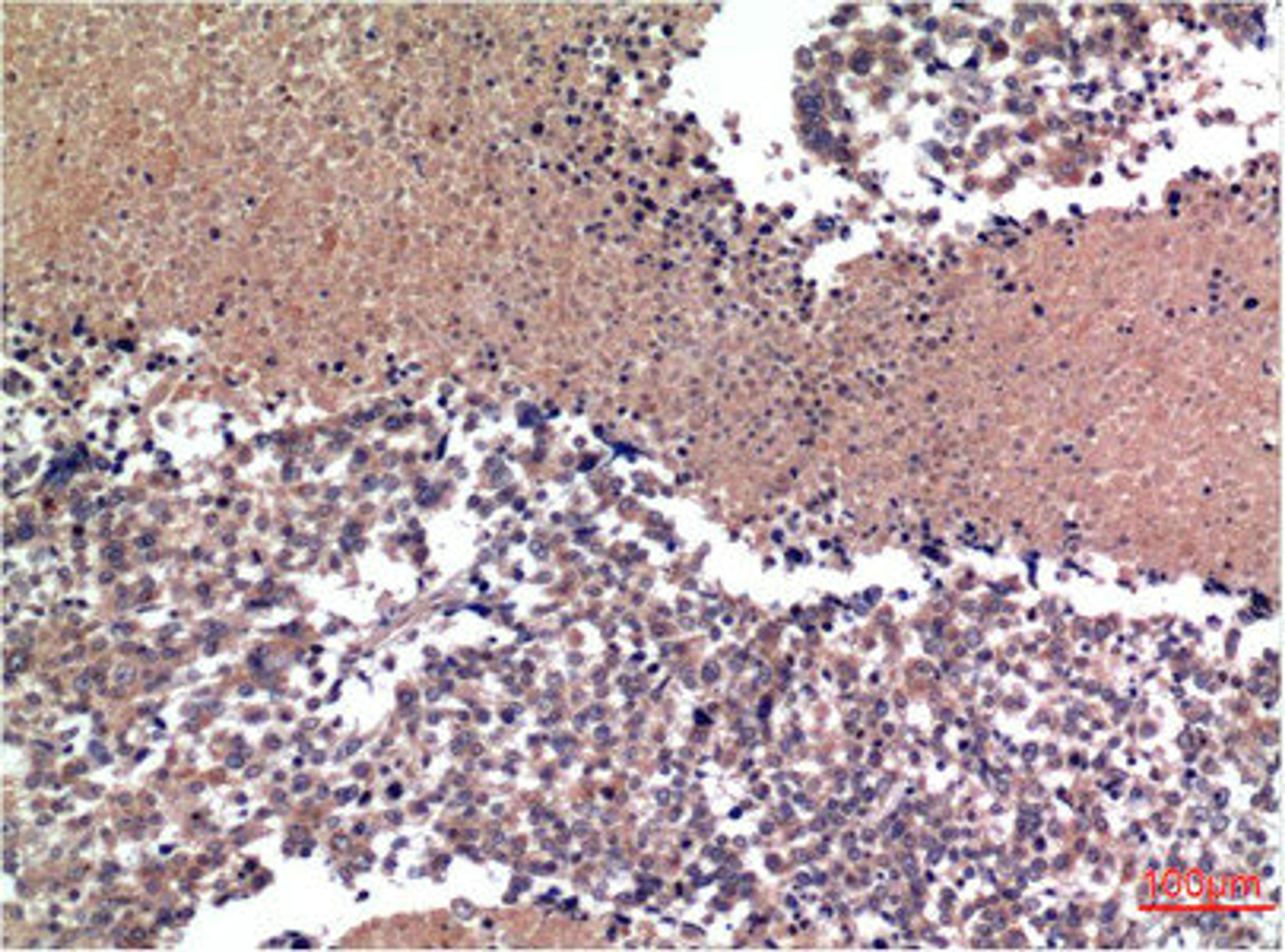Immunohistochemical analysis of paraffin-embedded Human lung Tissue using Cyclin B1 Mouse mAb diluted at 1:200.