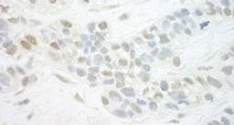 Detection of human MED13L by immunohistochemistry.