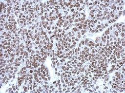 Immunohistochemistry-Paraffin: CBX1 Antibody [NBP2-14899] - Paraffin-embedded 59T xenograft, using antibody at 1:500 dilution.