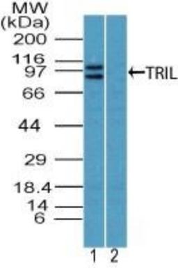 Western Blot: TLR4 Interactor With Leucine-Rich Repeats Antibody [NBP2-27168] - Analysis of TRIL using TRIL polyclonal antibody. Jurkat cell lysate in the 1) absence and 2) presence of immunizing peptide probed with TRIL antibody at 4 ug/ml. Goat anti-rabbit Ig HRP secondary antibody and PicoTect ECL substrate solution were used for this test.