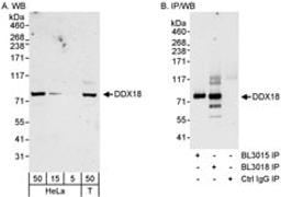 Detection of human DDX18 by western blot and immunoprecipitation.