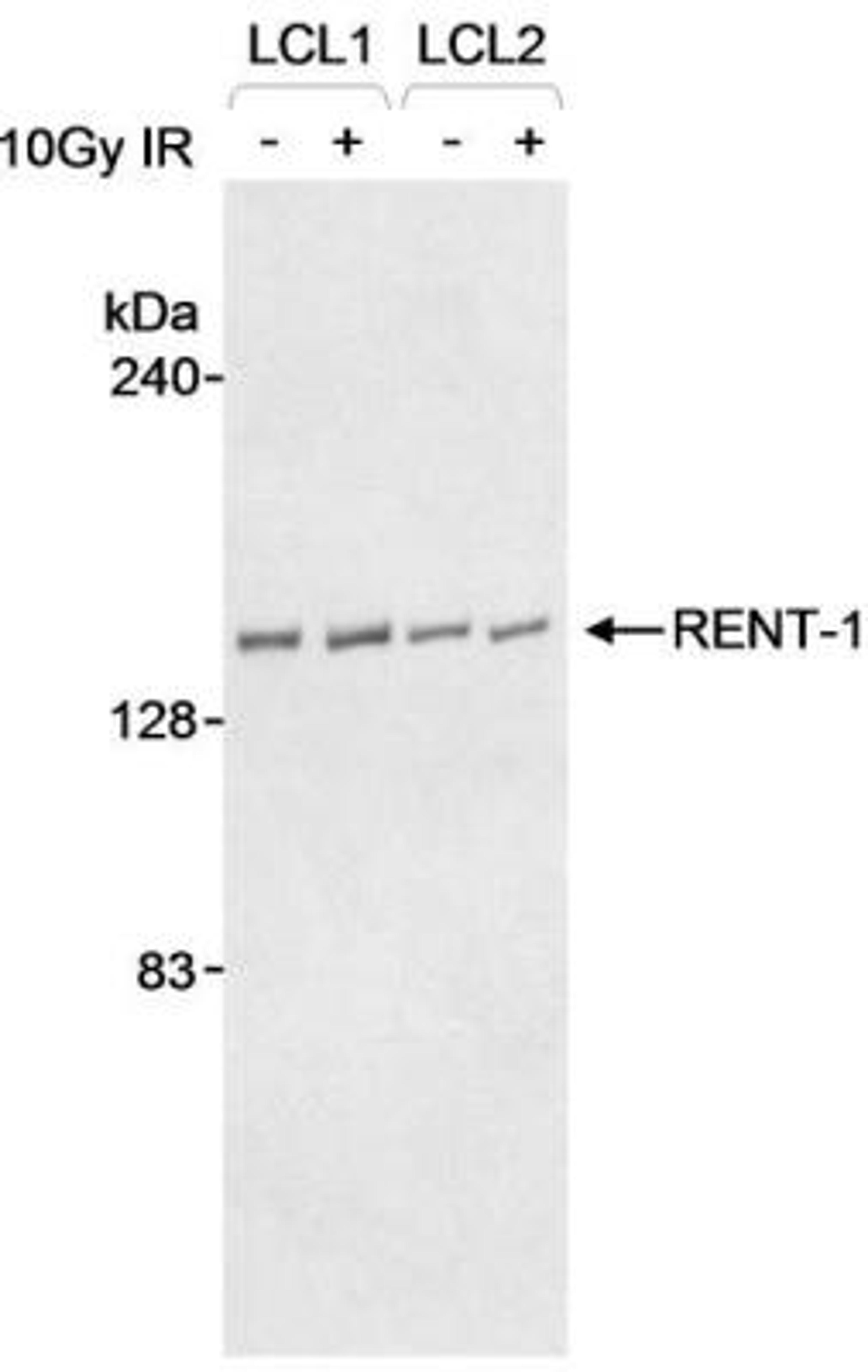 Western Blot: RENT1/UPF1/hUPF1 Antibody [NB100-368] - Whole cell  lysate (30 ug) from lymphoblastoid cell lines (EBV-immotalized B-cell from a normal individual). Antibody used at 1 ug/ml.