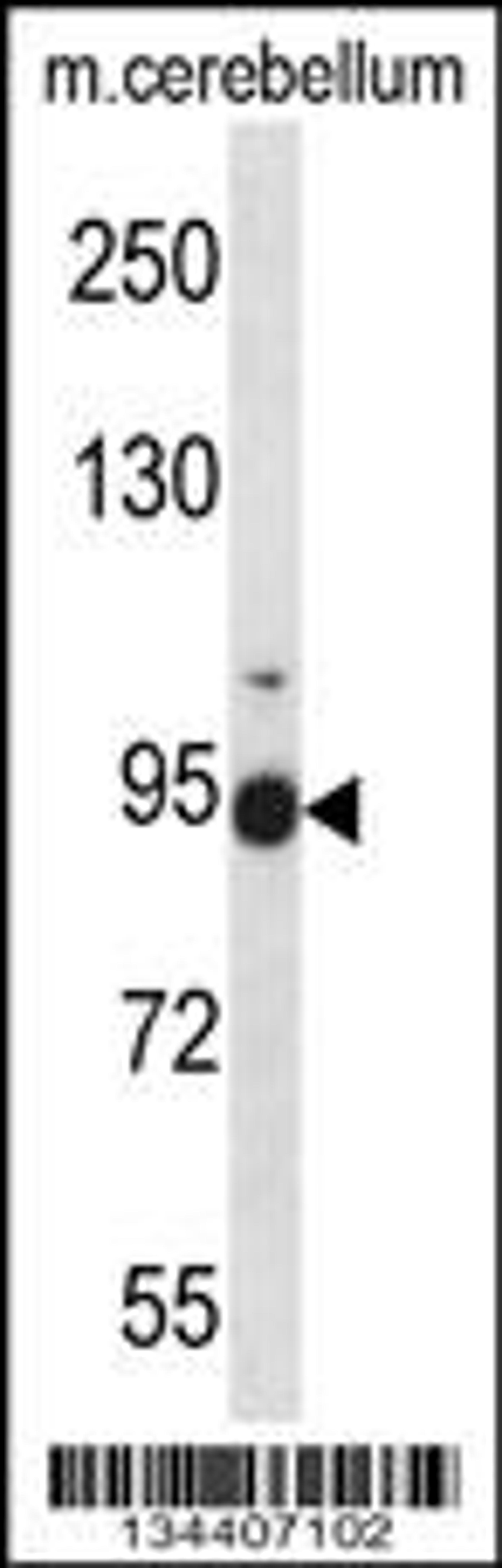 Western blot analysis in mouse cerebellum tissue lysates (35ug/lane).