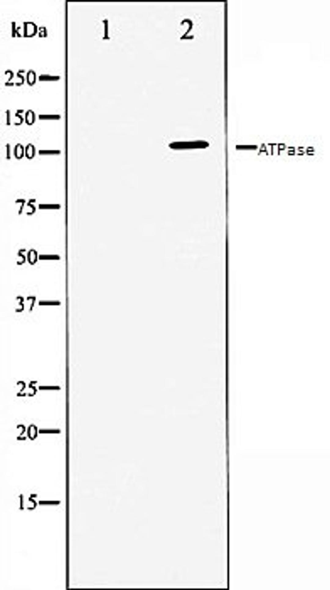 Western blot analysis of 293 whole cell lysates using ATPase antibody, The lane on the left is treated with the antigen-specific peptide.