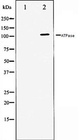 Western blot analysis of 293 whole cell lysates using ATPase antibody, The lane on the left is treated with the antigen-specific peptide.