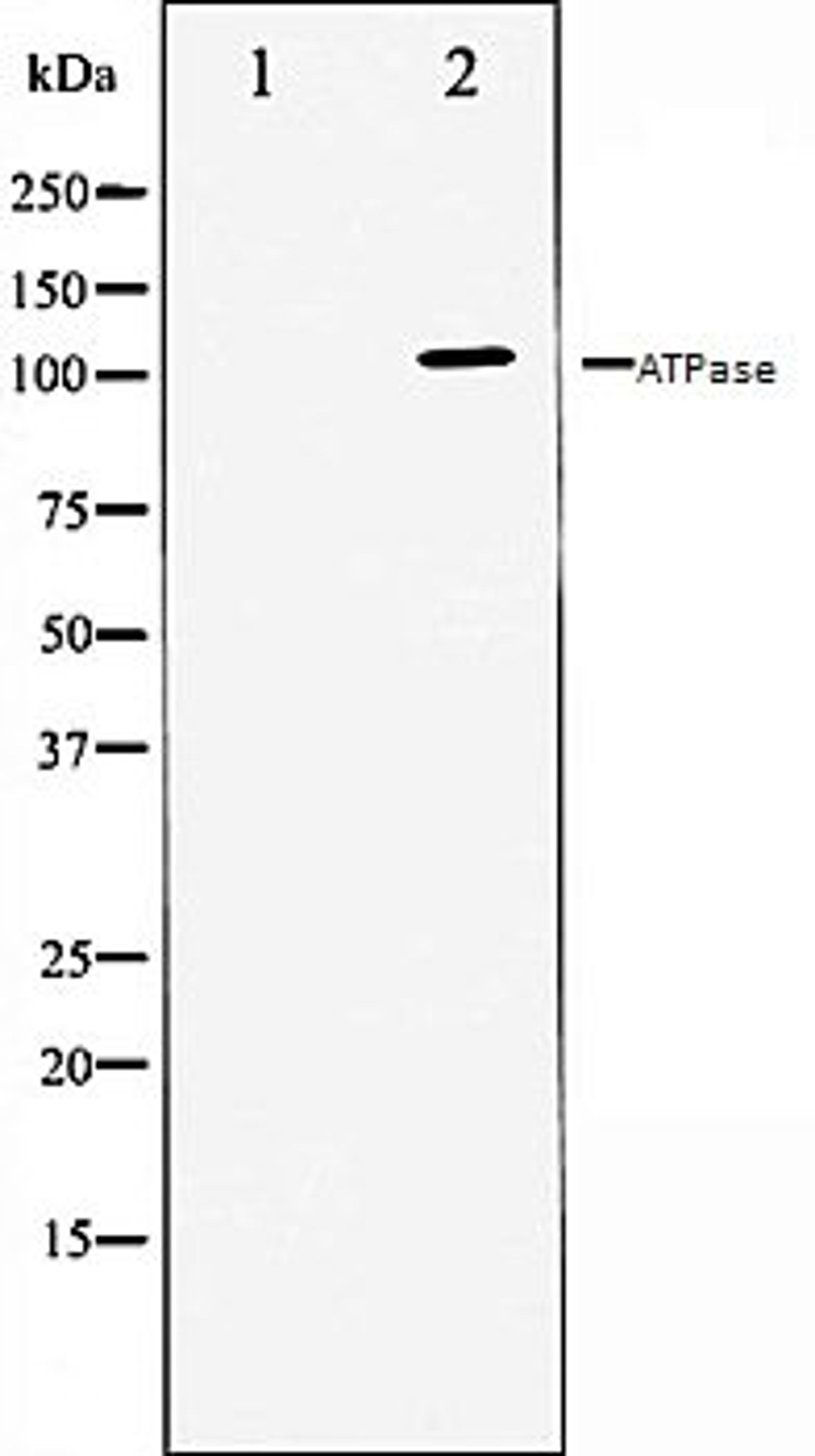 Western blot analysis of 293 whole cell lysates using ATPase antibody, The lane on the left is treated with the antigen-specific peptide.