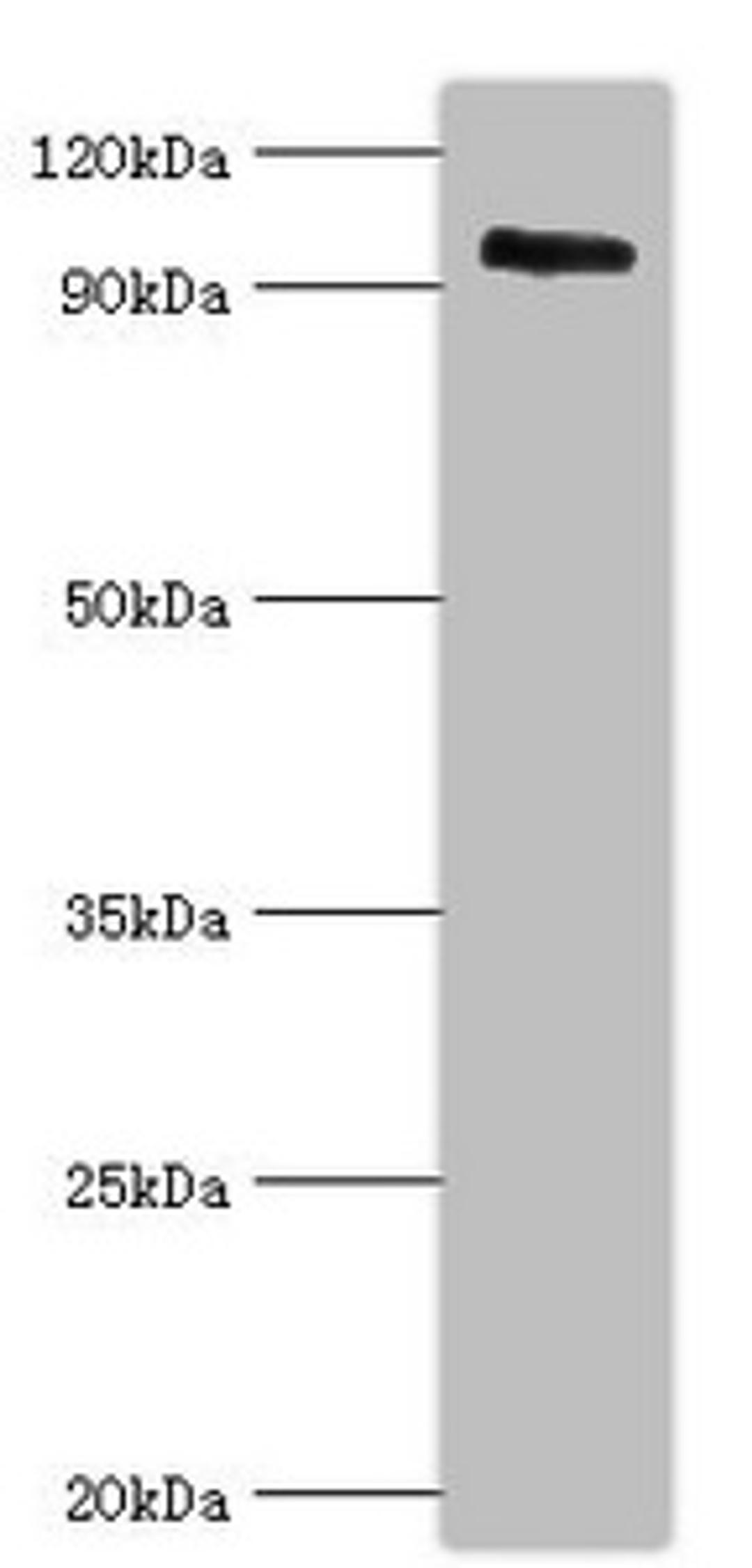 Western blot. All lanes: Calpain-3 antibody at 5ug/ml + Mouse brain tissue. Secondary. Goat polyclonal to rabbit IgG at 1/10000 dilution. Predicted band size: 95, 85, 94, 36, 19 kDa. Observed band size: 95 kDa. 