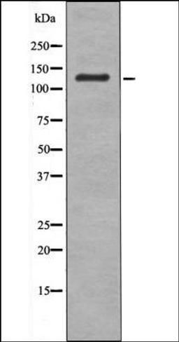 Western blot analysis of EGF treated HepG2 whole cell lysates using LATS1/2 -Phospho-Ser909/872- antibody