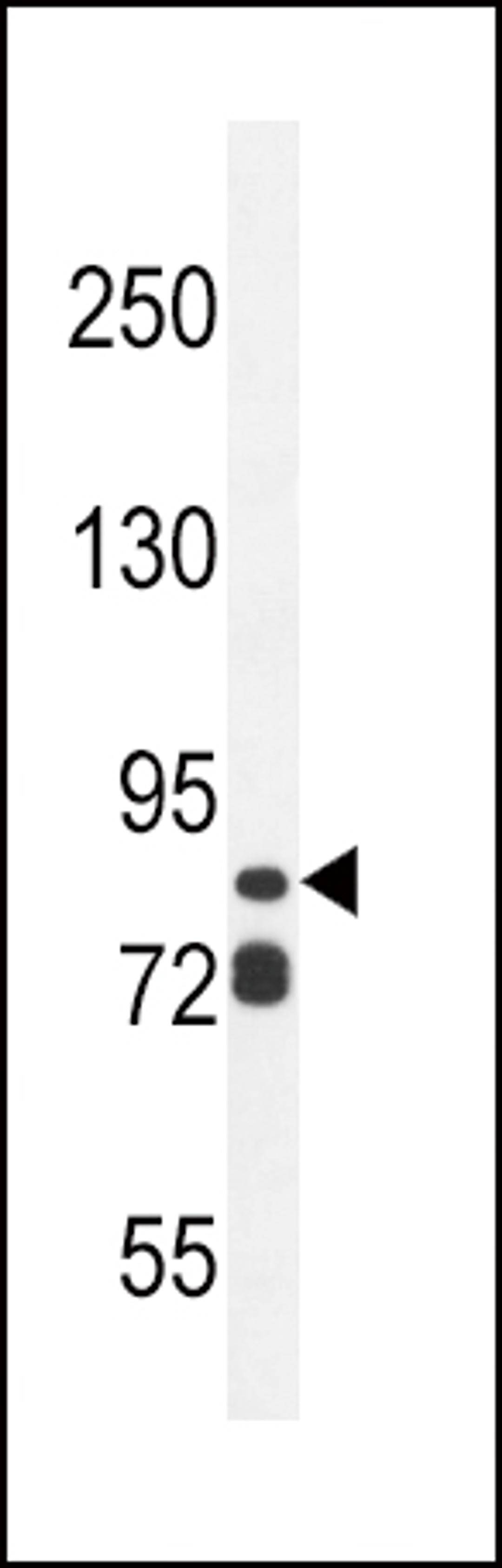 Western blot analysis in ZR-75-1 cell line lysates (35ug/lane).