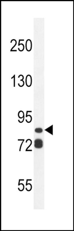 Western blot analysis in ZR-75-1 cell line lysates (35ug/lane).