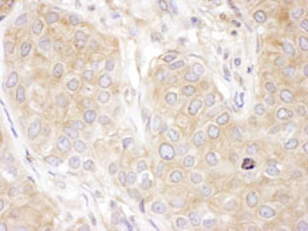 Detection of human DCTN2 by immunohistochemistry.