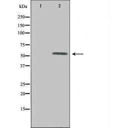 Western blot analysis of HepG2 cells using UEVLD antibody