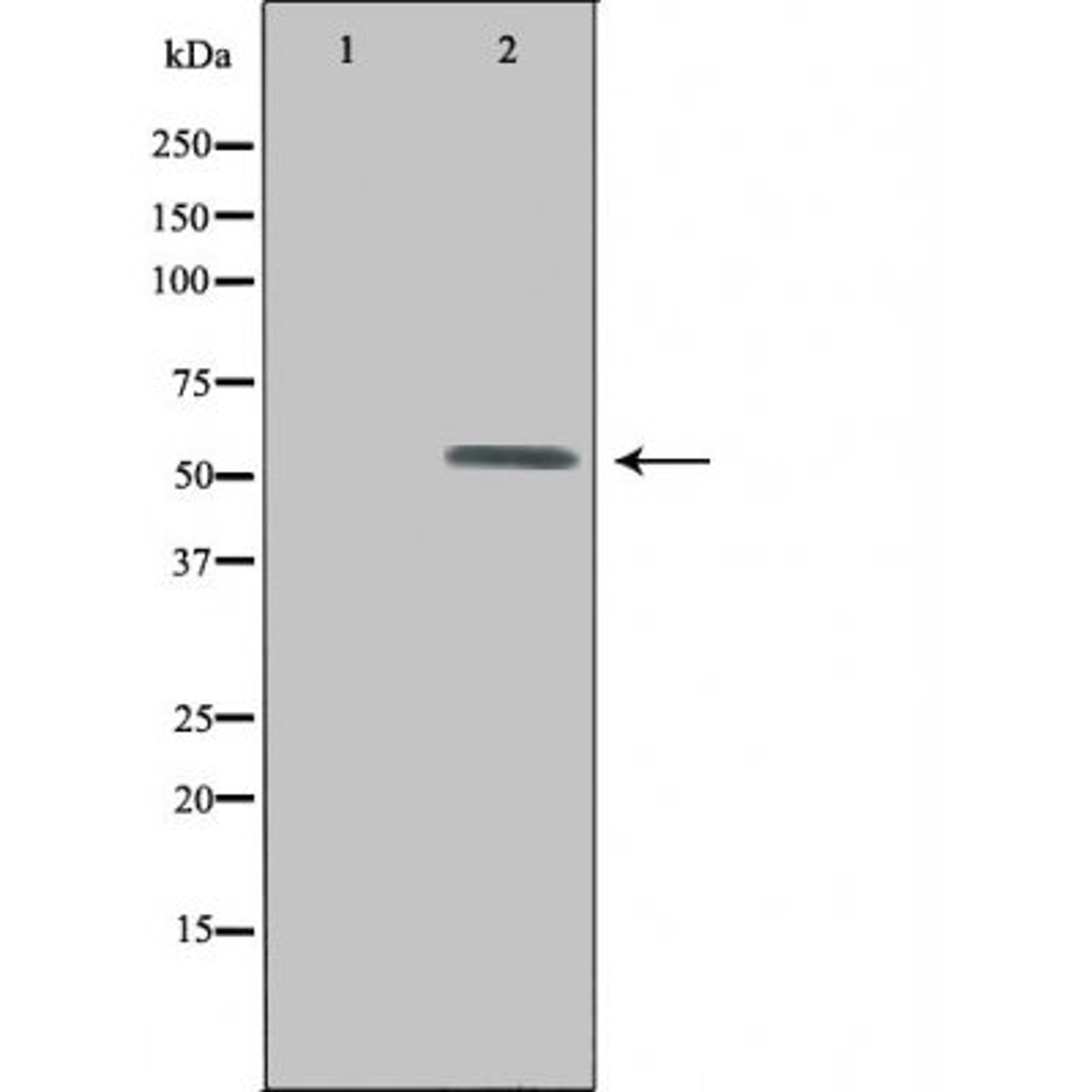 Western blot analysis of HepG2 cells using UEVLD antibody