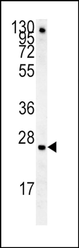 Western blot analysis in mouse lung tissue lysates (15ug/lane).This demonstrates the detected IGFBP4 protein (arrow).