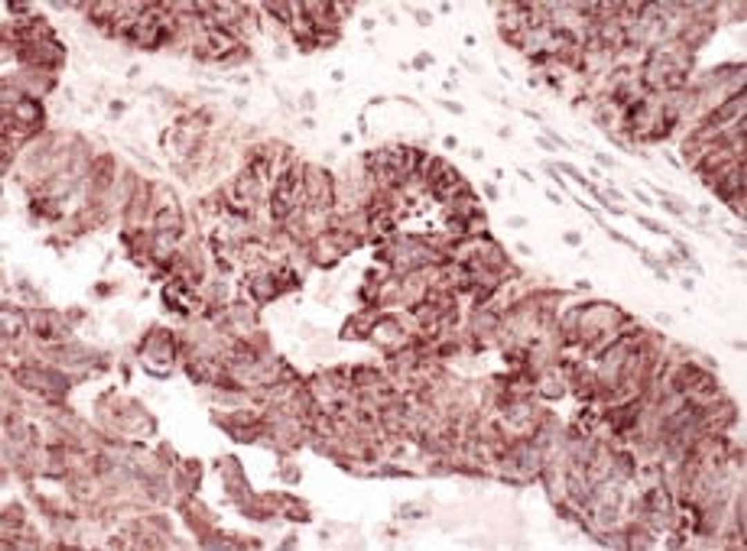 Detection of human C1QBP by immunohistochemistry.