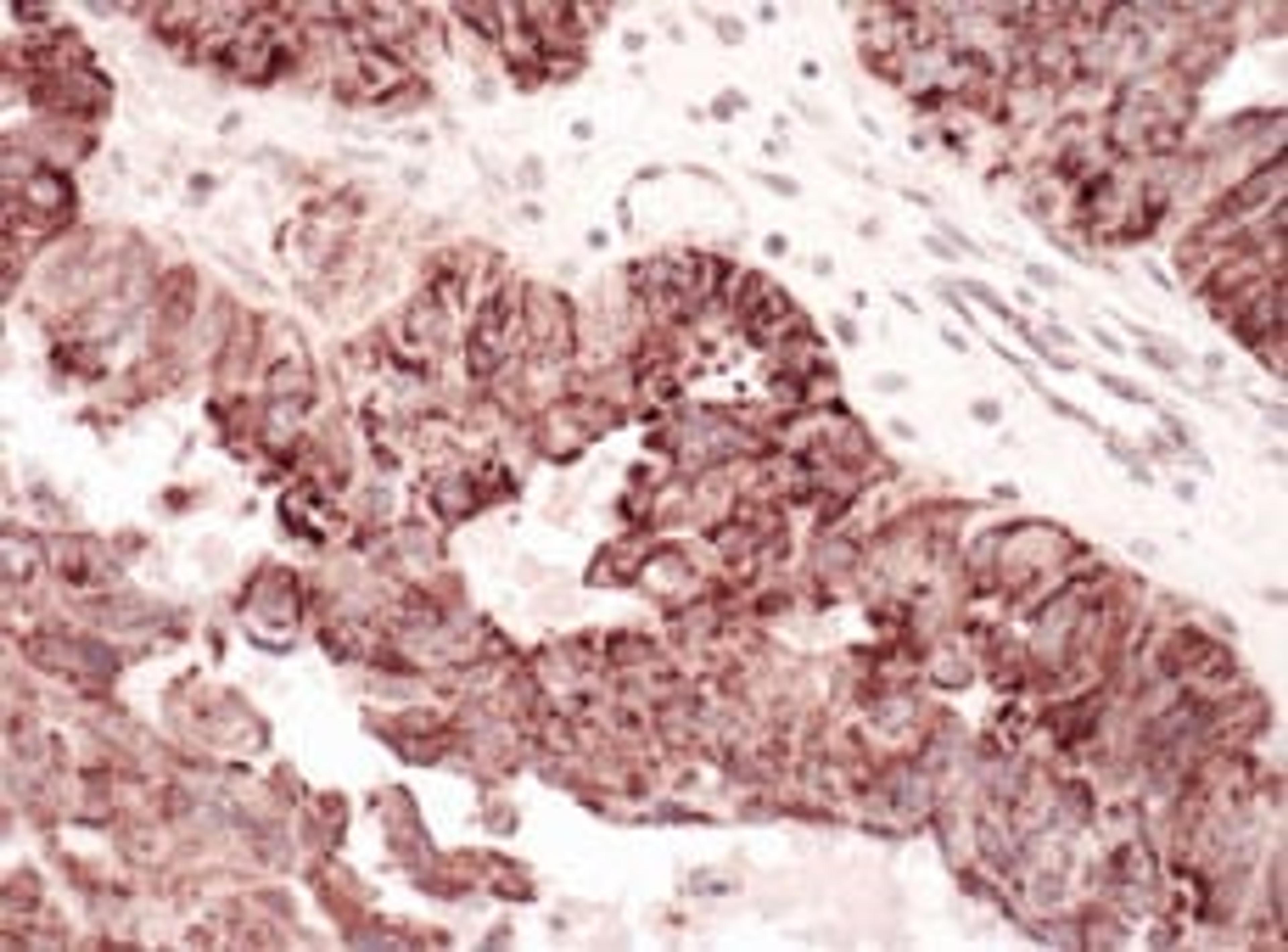 Detection of human C1QBP by immunohistochemistry.