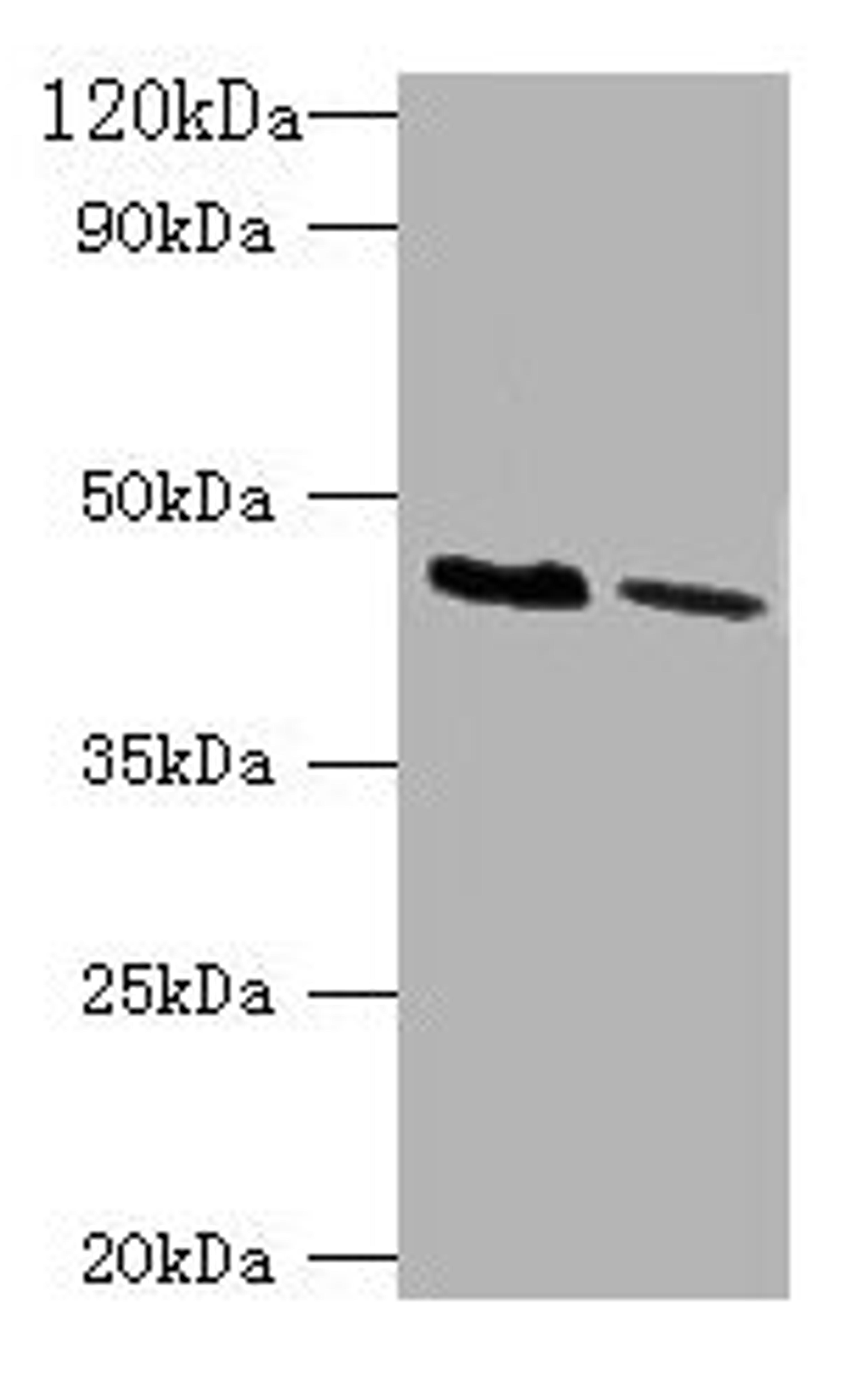 Western blot. All lanes: KCNJ1 antibody at 2µg/ml. Lane 1: HepG2 whole cell lysate. Lane 2: Hela whole cell lysate. Secondary. Goat polyclonal to rabbit IgG at 1/10000 dilution. Predicted band size: 45, 43 kDa. Observed band size: 45 kDa