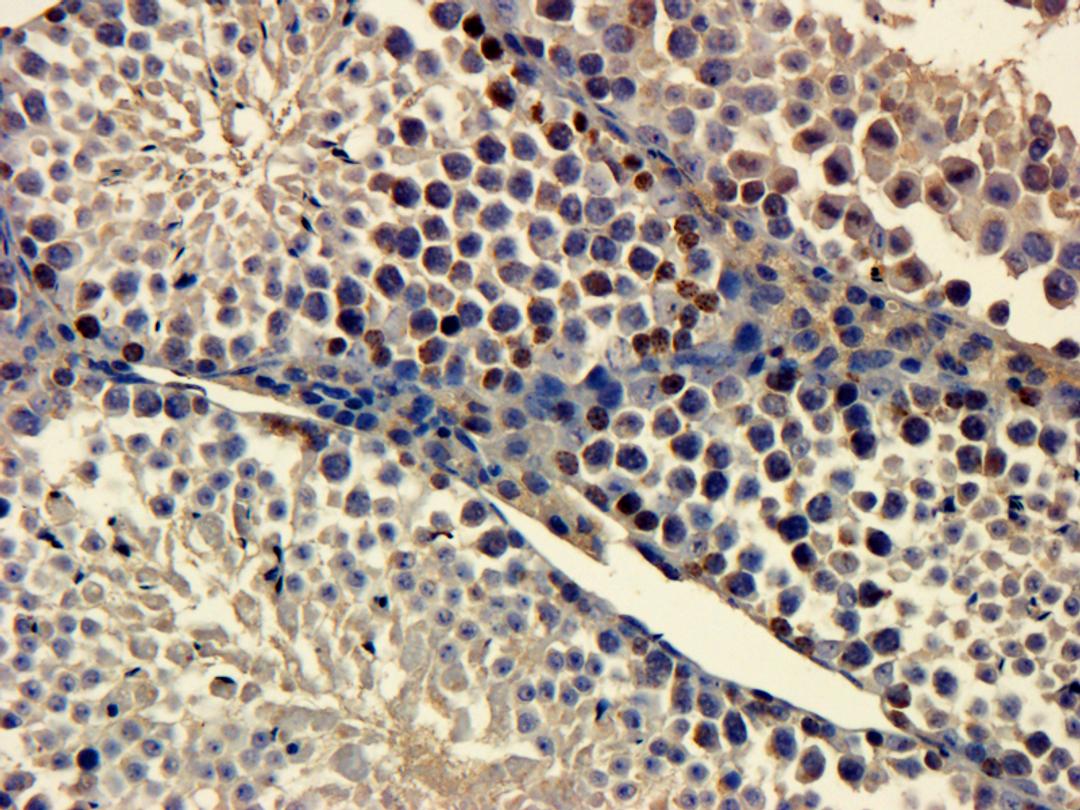 IHC-P image of mouse testis tissue using Ki67 antibody (dilution of primary antibody at 1:200)