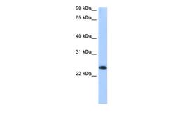 Antibody used in WB on Human Brain at 0.2-1 ug/ml.