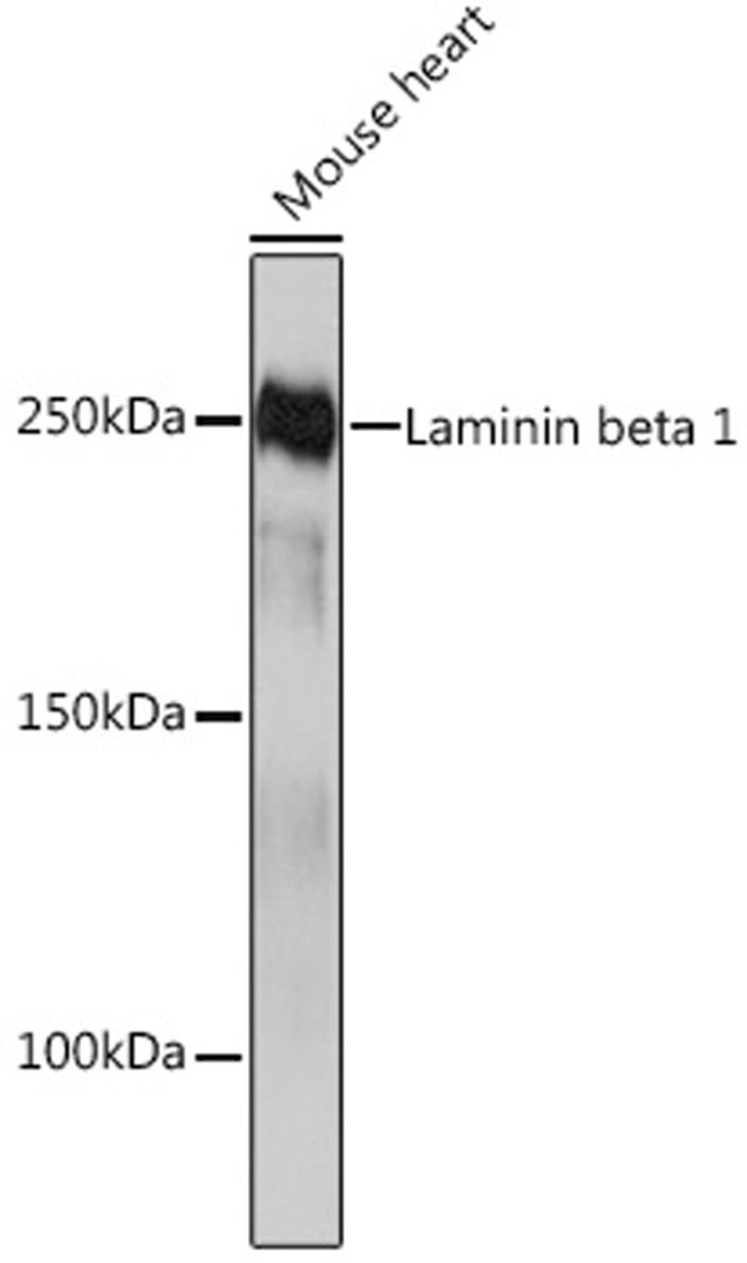 Western blot - Laminin beta 1 Rabbit mAb (A4373)