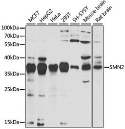 Western blot - SMN2 antibody (A12519)