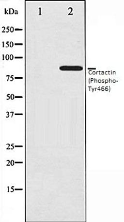 Western blot analysis of COS7 whole cell lysates using Cortactin (Phospho-Tyr466) antibody, The lane on the left is treated with the antigen-specific peptide.